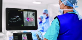 Philips anuncia el lanzamiento de Echonavigator 4.0