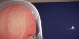 Neuralink pretende manejar un brazo robótico con el cerebro