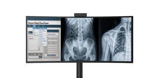 LG introduce un monitor de diagnóstico de 40″ con autorización de la FDA